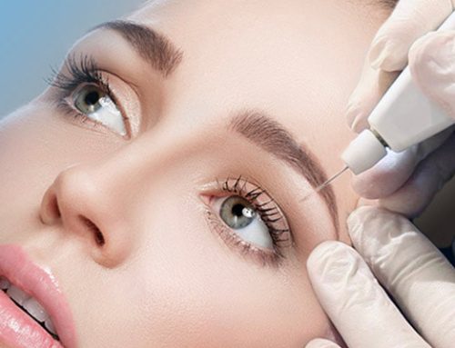 Blefaroplastia sem cortes